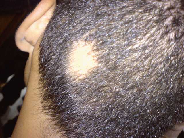 crecimiento del cabello
